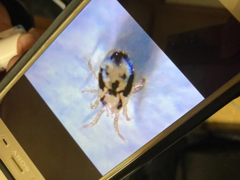 顕微鏡で拡大した虫の様子